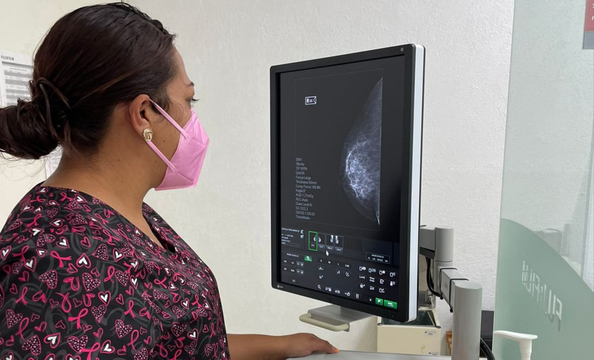 Hidalgo registra 186 casos de cáncer de mama en 2026