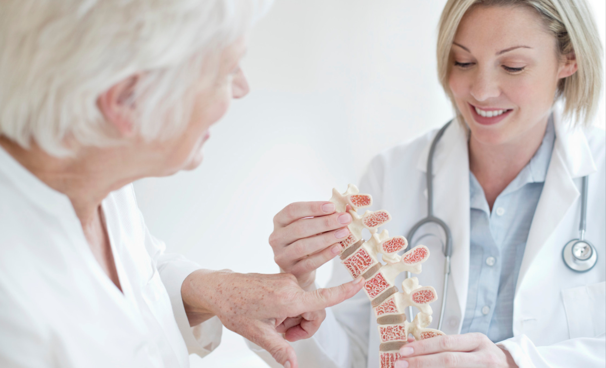 Osteoporosis: afecta a una de cada tres mujeres mayores de 50 años